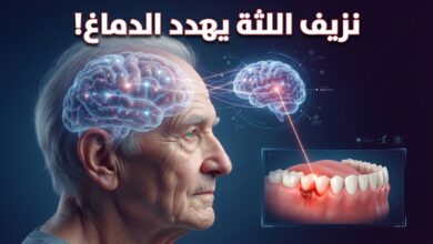 دراسة ترصد مؤشرا خطيرا بأن نزيف اللثة يرفع خطر الإصابة بالخرف