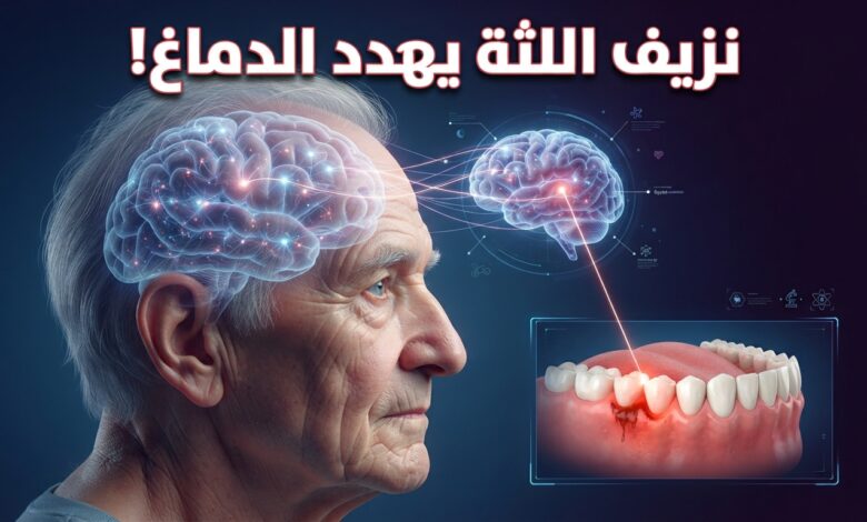 دراسة ترصد مؤشرا خطيرا بأن نزيف اللثة يرفع خطر الإصابة بالخرف