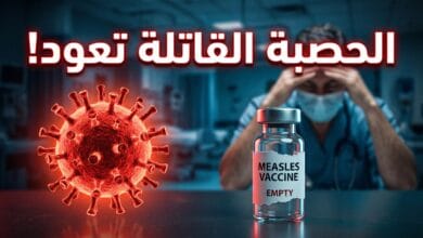 فيروس الحصبة يضرب الولايات المتحدة وسط تراجع معدلات التطعيم وتزايد الوفيات في ولاية بنسلفانيا